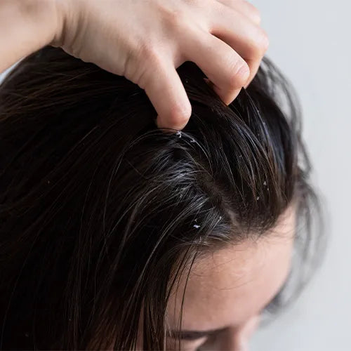 Anti-Dandruff