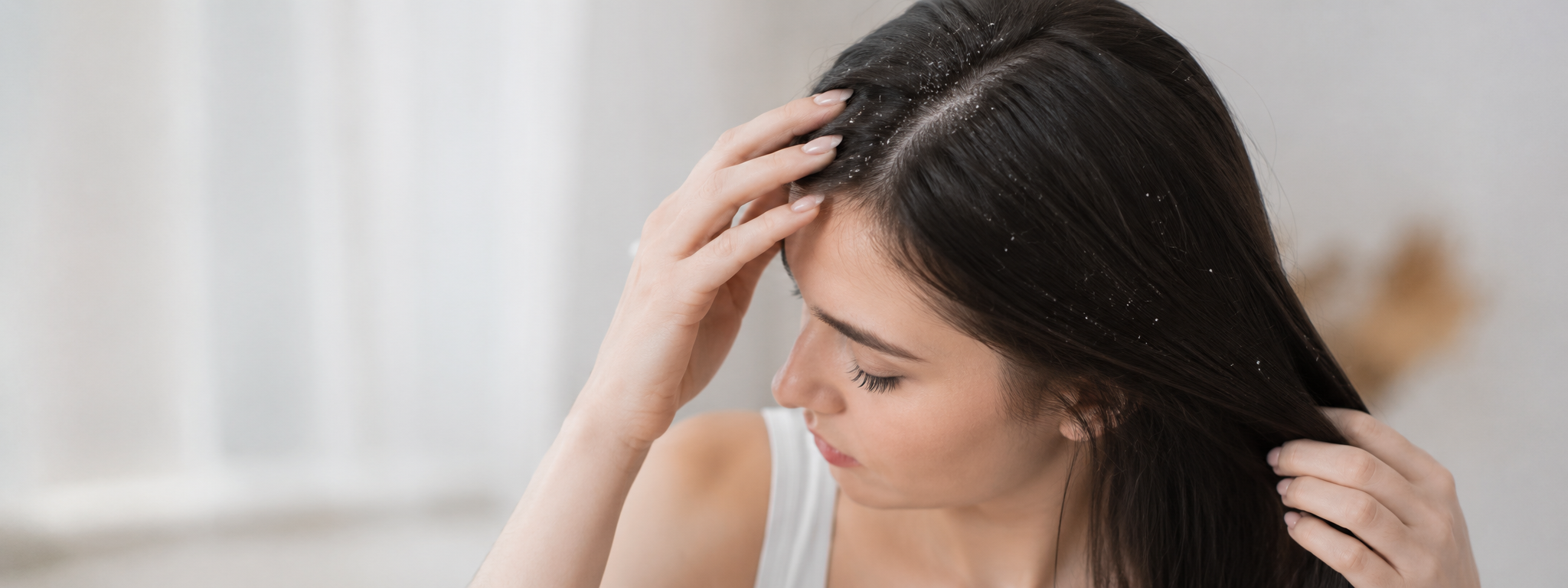 Anti Dandruff