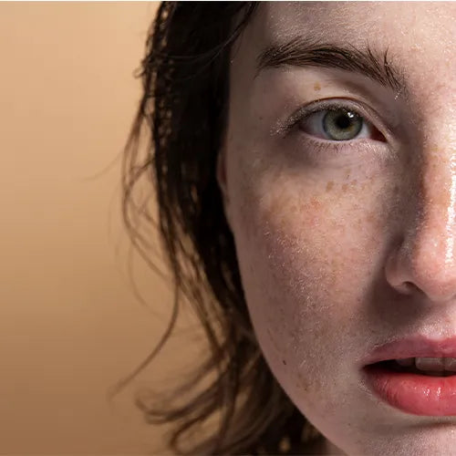 Face Pigmentation
